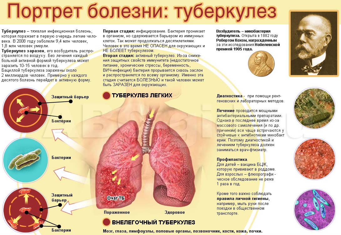 Плакат-Туберкулез.jpg?gid=66