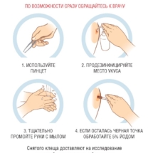 Как снять клеща Как снять клеща