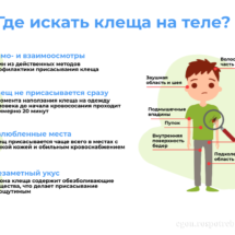 Где искать клеща на теле Где искать клеща на теле
